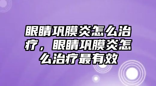 眼睛鞏膜炎怎么治療，眼睛鞏膜炎怎么治療最有效