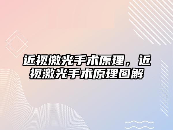 近視激光手術原理，近視激光手術原理圖解