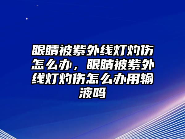 眼睛被紫外線燈灼傷怎么辦，眼睛被紫外線燈灼傷怎么辦用輸液嗎