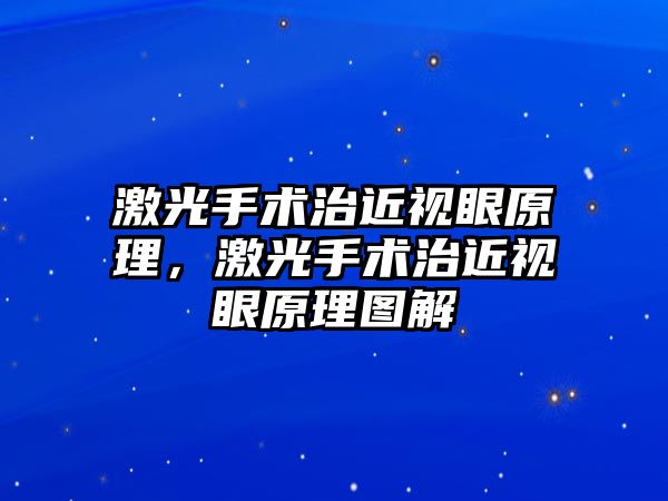 激光手術(shù)治近視眼原理，激光手術(shù)治近視眼原理圖解