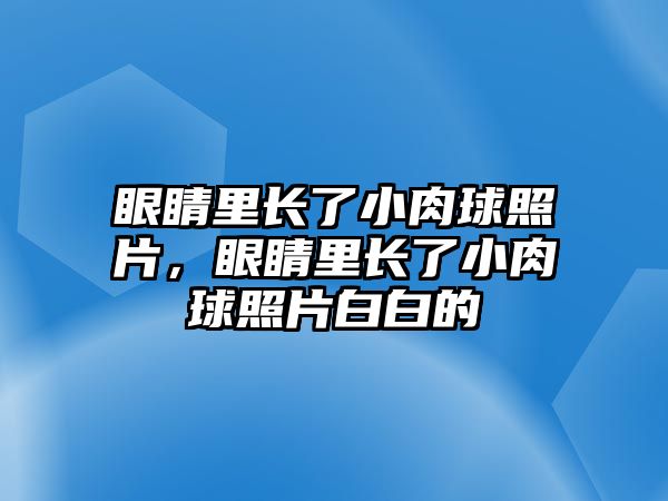 眼睛里長(zhǎng)了小肉球照片，眼睛里長(zhǎng)了小肉球照片白白的