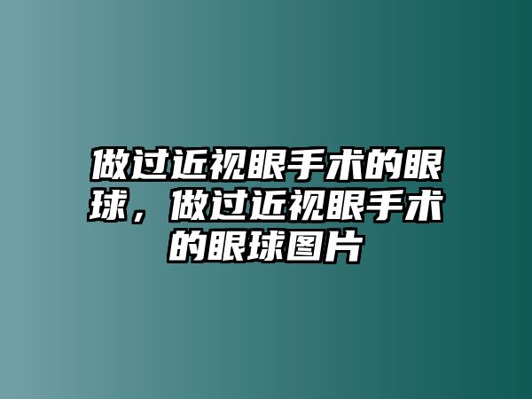 做過近視眼手術的眼球，做過近視眼手術的眼球圖片