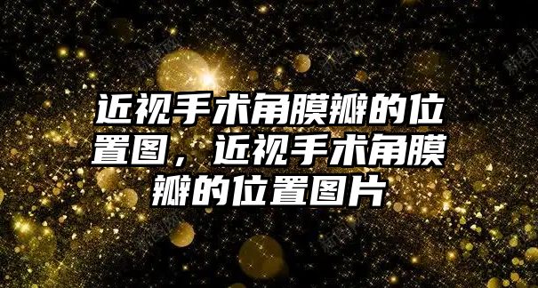 近視手術(shù)角膜瓣的位置圖，近視手術(shù)角膜瓣的位置圖片