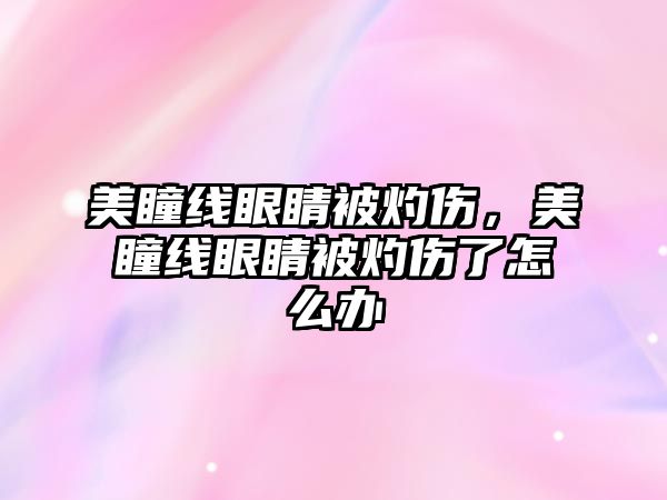 美瞳線眼睛被灼傷，美瞳線眼睛被灼傷了怎么辦